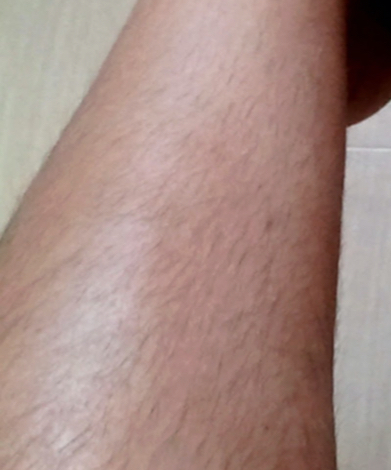 Avant jambe