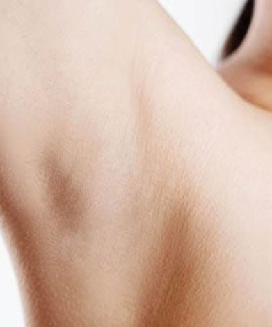 epilation-apres-2 (1)