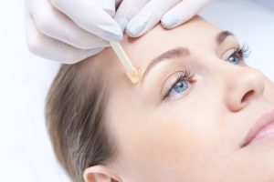 Epilation visage