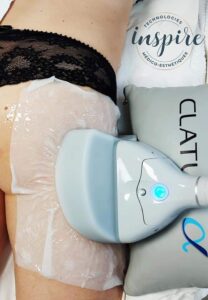 Soin minceur cryolipolyse - Institut Estetica Beaute