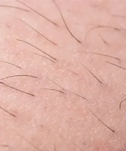 Diagnostic épilation définitive maillot - Institut de beauté Estética Beauté