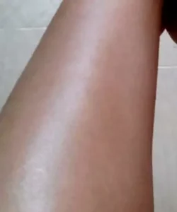 Resultat épilation définitive jambe - Institut de beauté Estética Beauté